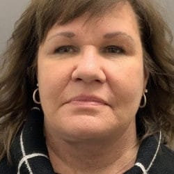 After Image: Facelift and Upper Blepharoplasty by Dr. Thompson - front