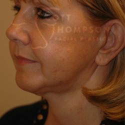 After Image