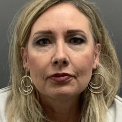 Before Image: Facelift and Upper Blepharoplasty by Dr. Henstrom - front