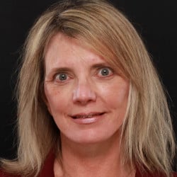 After Image: Facelift, Browlift, Fat Transfer, Lip Lift, Upper Blepharoplasty, and Skin Pinch by Dr. Thompson - front