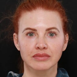 After Image