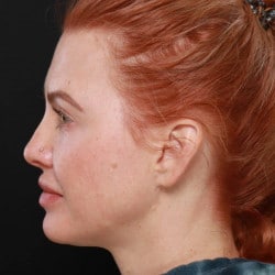 After Image