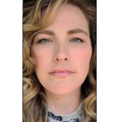 After Image: Facelift by Dr. Thompson - front