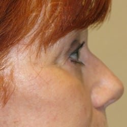 After Image