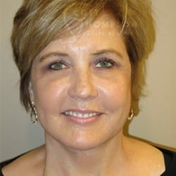 After Image: Facelift and Chin Implant by Dr. Thompson