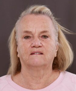 Before Image: Contour TRL & BBL by Katy Larson