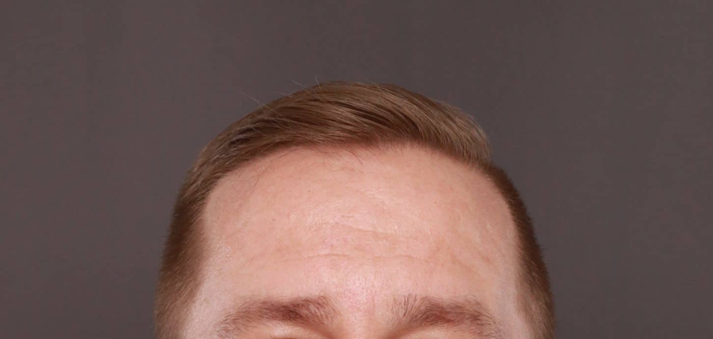 Before Image