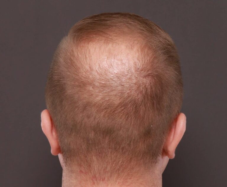 Before Image