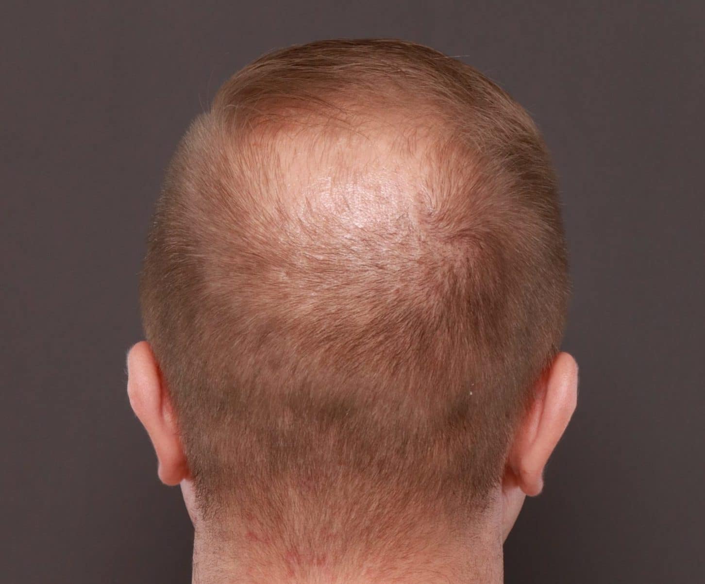 Before Image