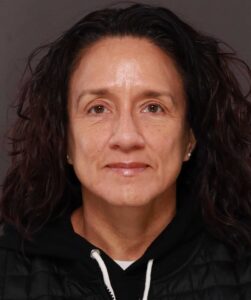 Lower Blepharoplasty with Periorbital Fat Transfer by Dr. Henstrom