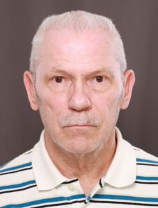 Upper & Lower Blepharoplasty, Rhinoplasty by Dr. Henstrom