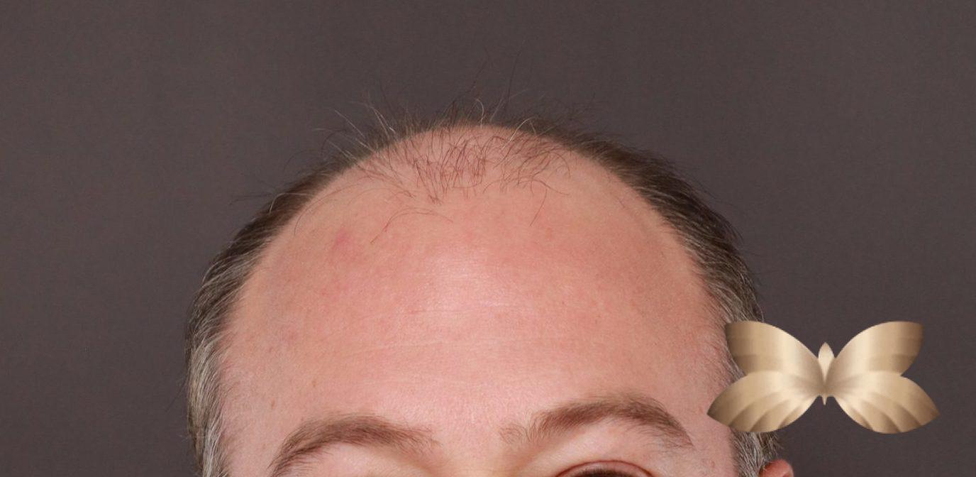 Before Image