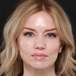 After Image: Revision Rhinoplasty by Dr. Henstrom - front