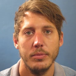 Before Image: Septorhinoplasty by Dr. Henstrom - front