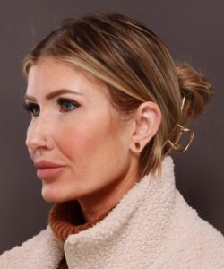 Gauged Earlobe Repair by Dr. Manning