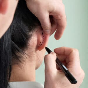 risks of ear pinning