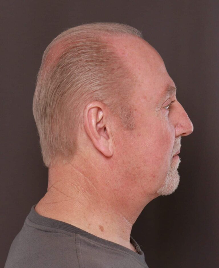 After Image
