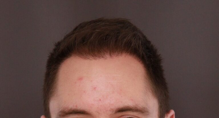 After Image