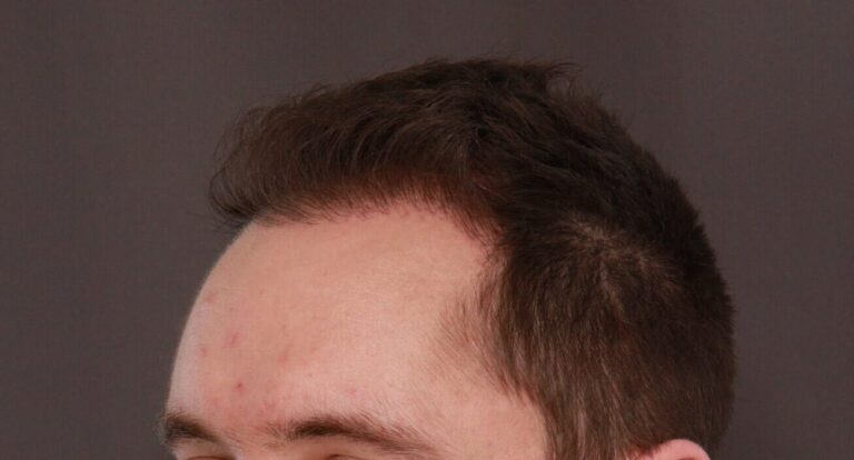 After Image