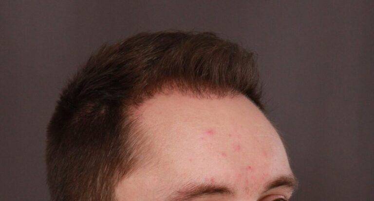 After Image