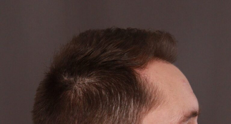 After Image