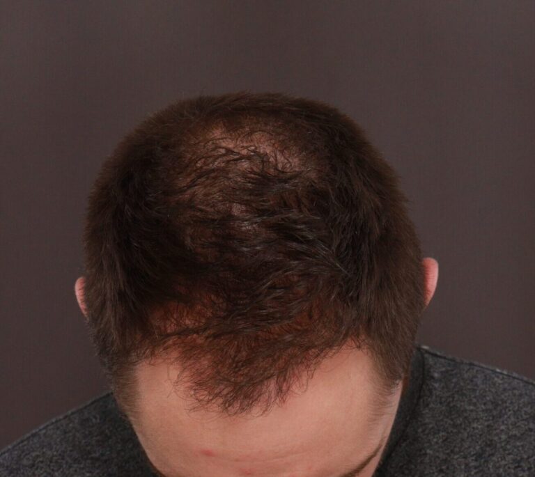 After Image