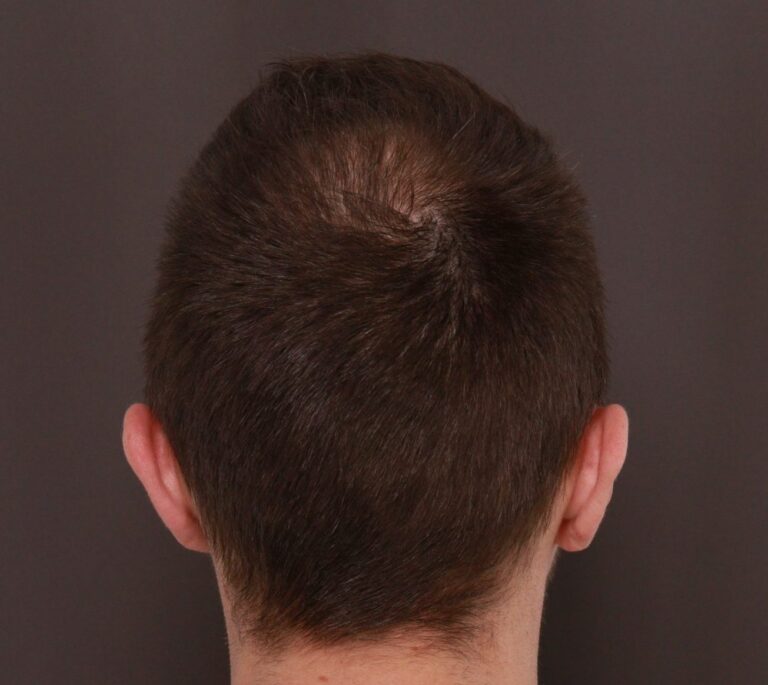 After Image