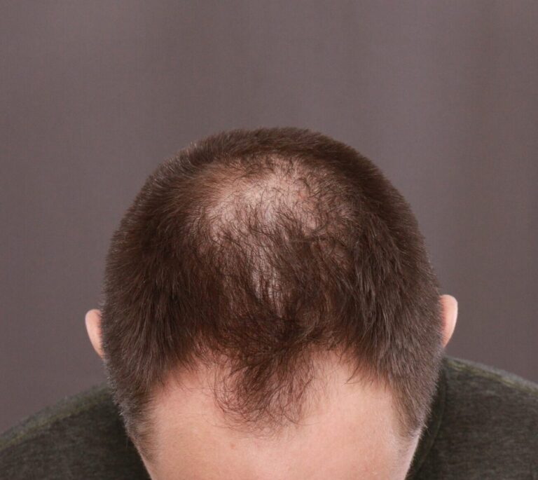 Before Image