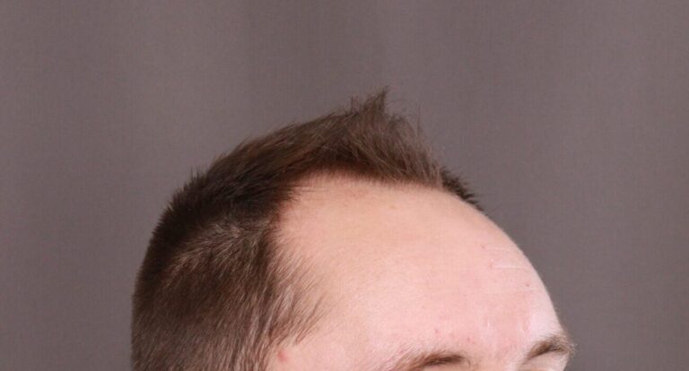 Before Image