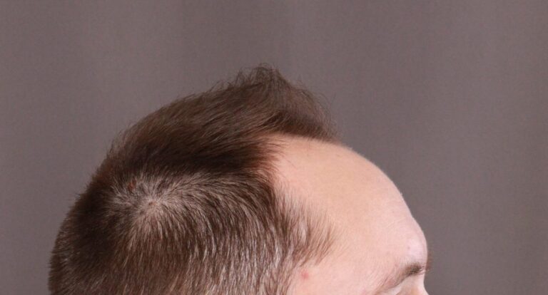 Before Image