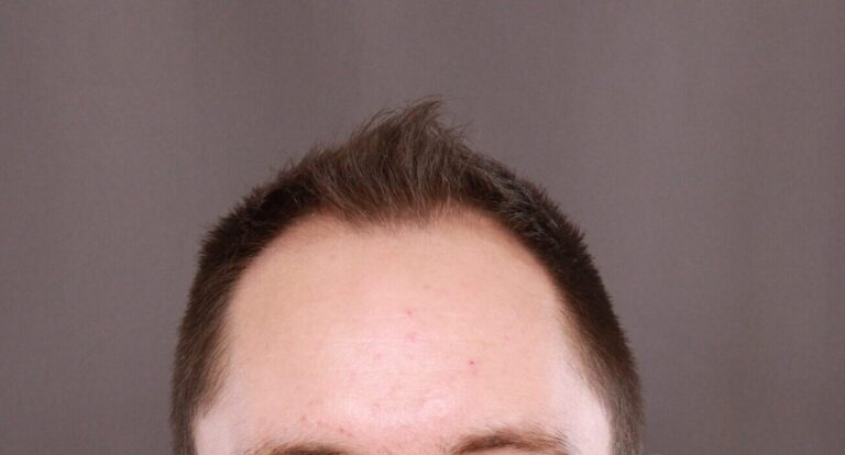 Before Image