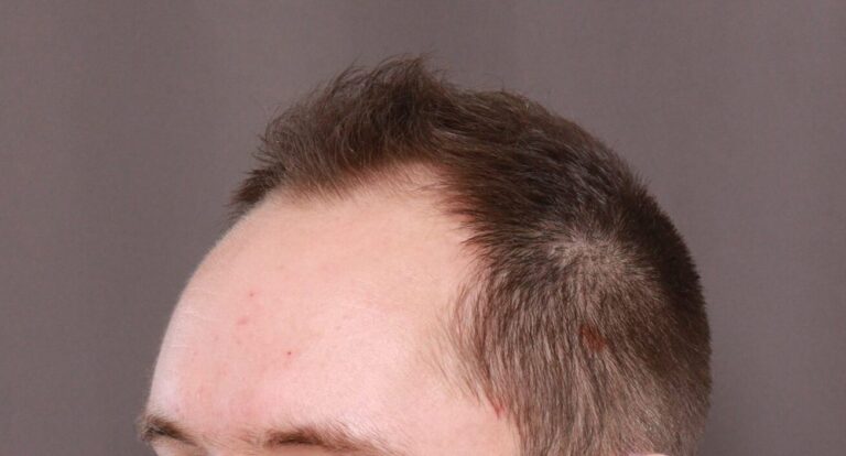 Before Image