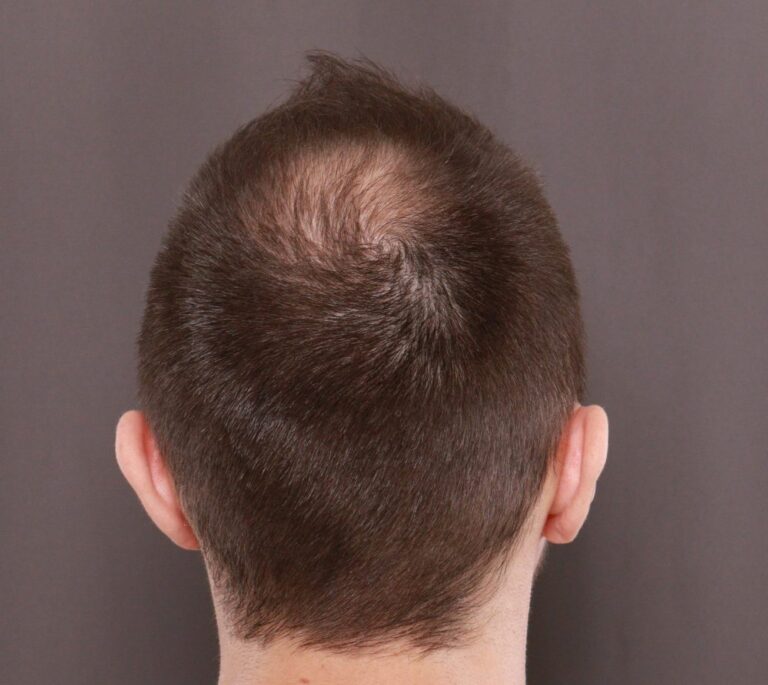 Before Image
