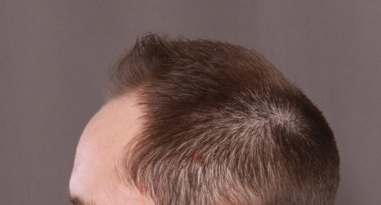 Before Image
