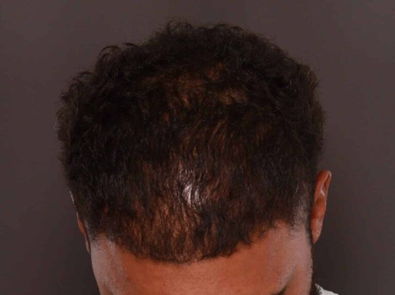 After Image