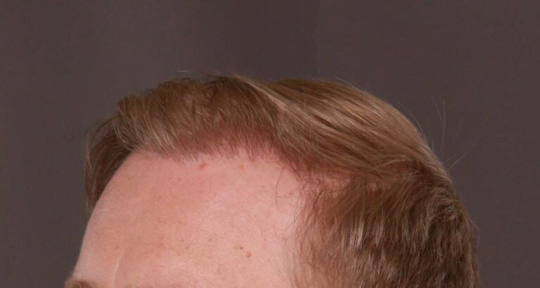 After Image