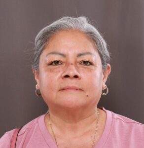 Upper Blepharoplasty by Dr. Henstrom