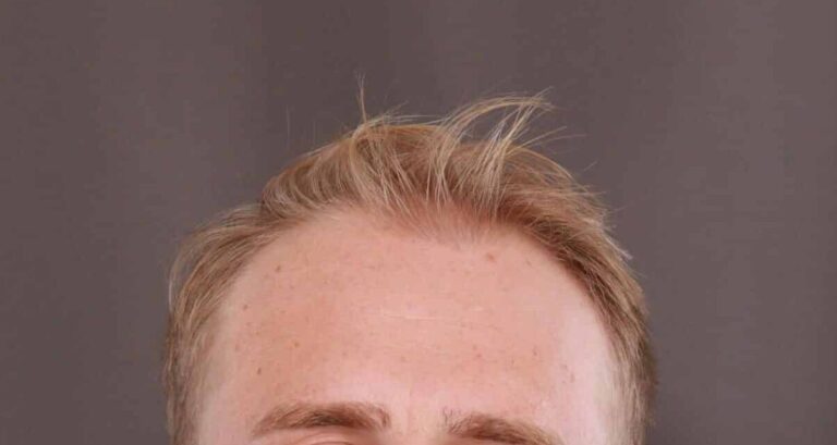 Before Image