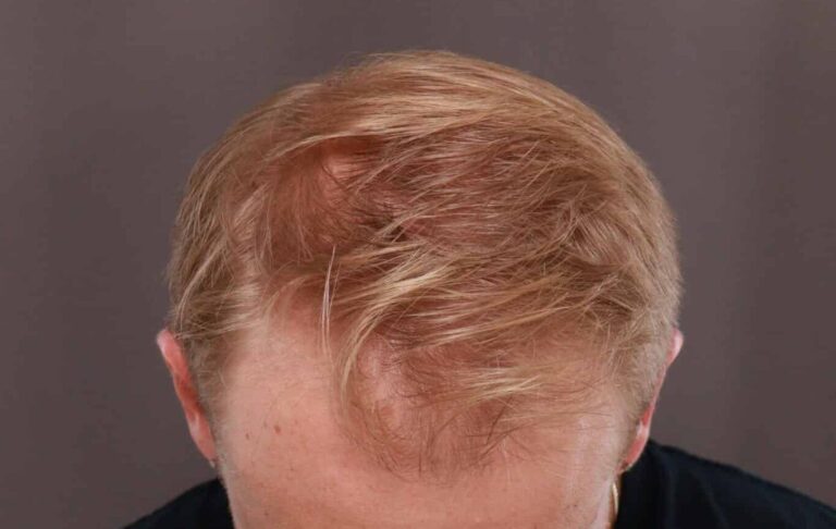 Before Image