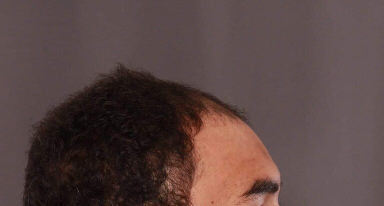 Before Image