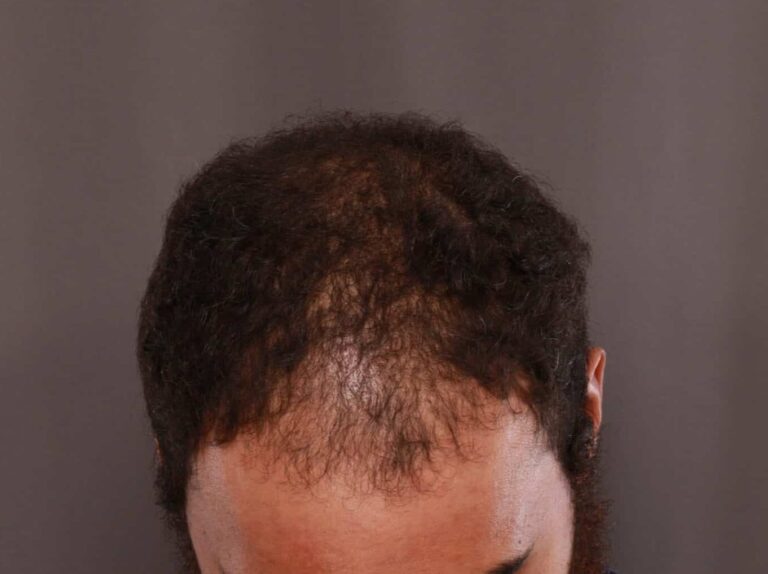 Before Image