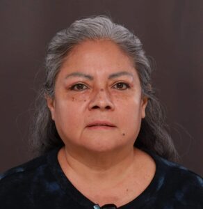Upper Blepharoplasty by Dr. Henstrom