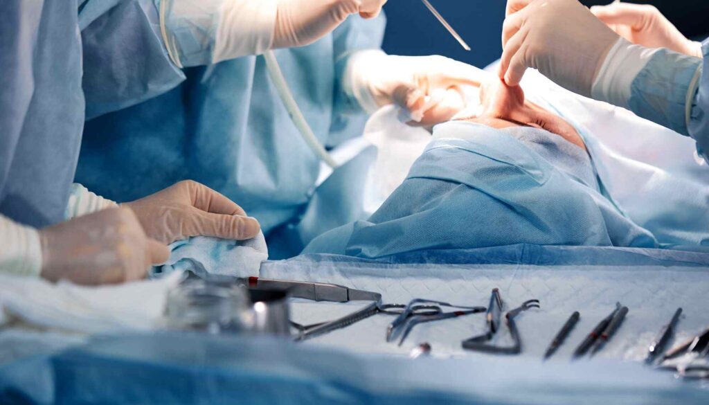 Septoplasty