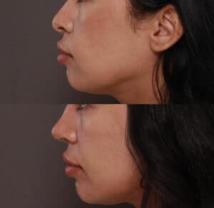 rhino profile 2 rhino profile 2