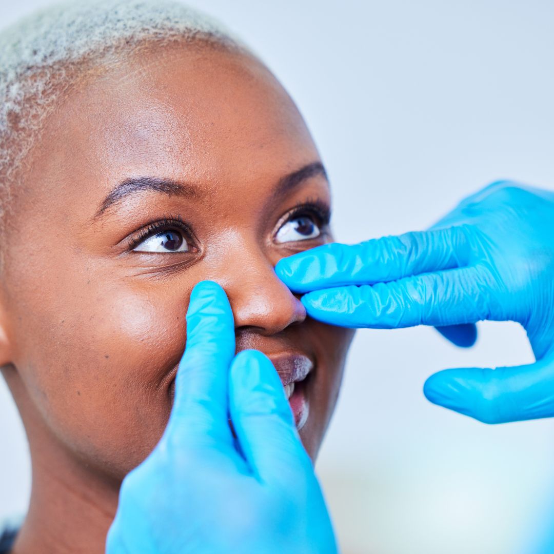 Ethnic Rhinoplasty: A Comprehensive Guide to Nose Surgery for