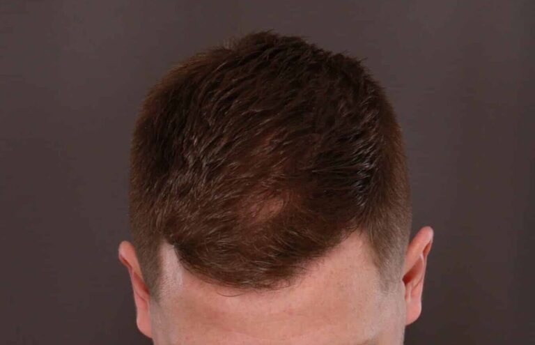 After Image