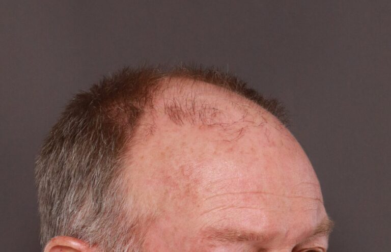 Before Image