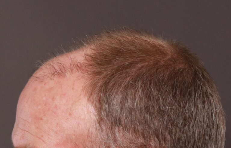 Before Image