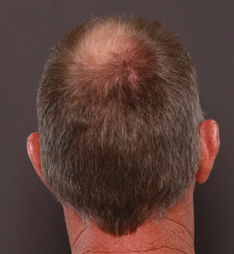 Before Image