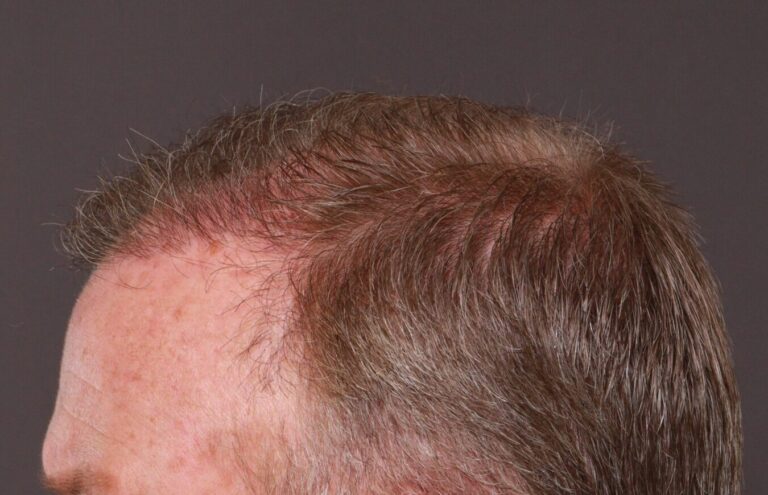 After Image